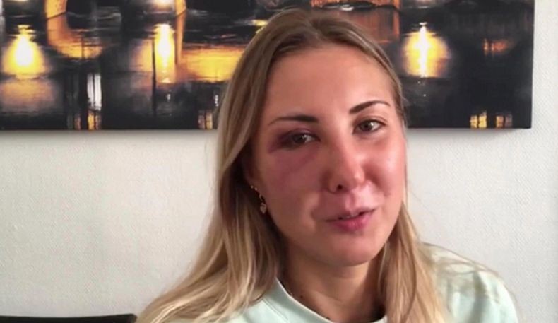 Elisabeth, mahasiswi yang dikeroyok tiga pria di Strasbourg, Prancis, karena memakai rok terlalu pendek (NEWFLASH/THE SUN))